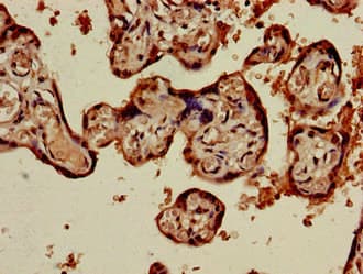 Polyclonal Rabbit anti-Human PRSS1 / Trypsin Antibody (IHC)