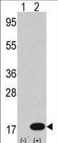 Polyclonal Rabbit anti-Human MAP1LC3B / LC3B Antibody (aa1-30, IHC, IF, WB)