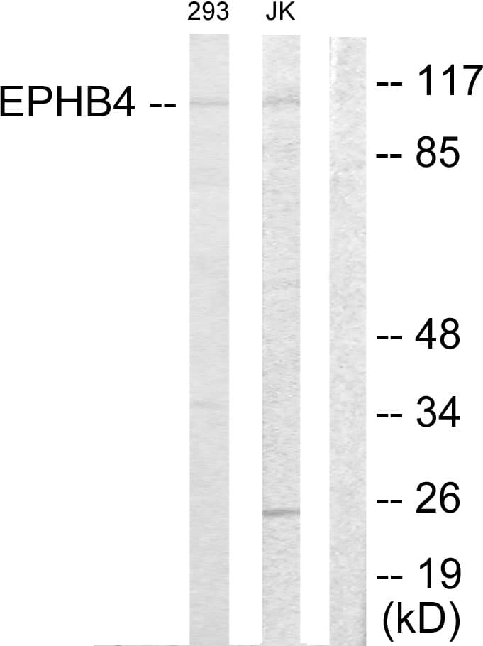 EPHB4 / EPH Receptor B4 Antibody (aa571-620)