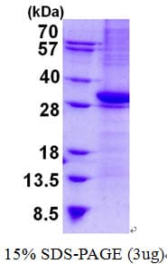 Human CD1B Protein (Recombinant His)