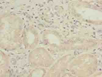 Polyclonal Rabbit anti-Human GALNT15 / GALNTL2 Antibody (IHC, WB)