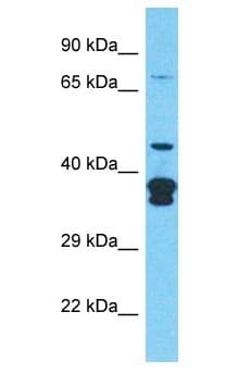 CLASP2 Antibody (aa1-50)