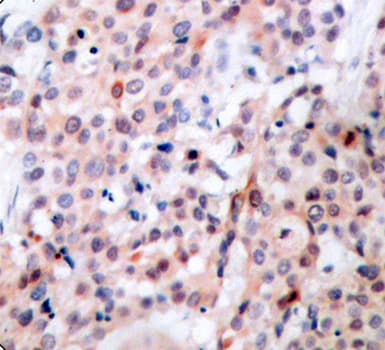 Polyclonal Rabbit anti-Human BCL2 / Bcl-2 Antibody (phospho-Thr56, IHC)