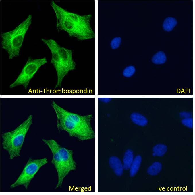 IHC-plus™ THBS1 / Thrombospondin-1 Antibody (aa19-32)