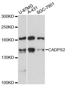 Polyclonal Rabbit anti-Human CADPS2 Antibody (WB)