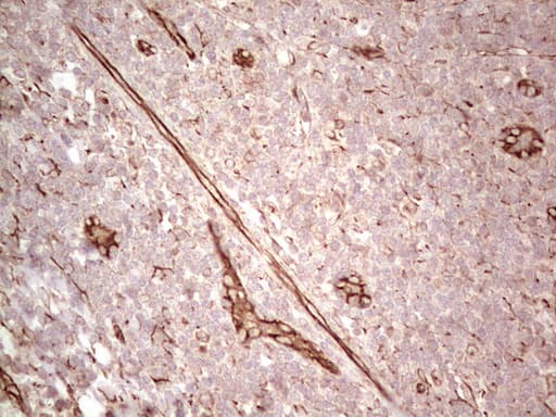 CFI / Complement Factor I Antibody (aa340-583, clone OTI17C5)