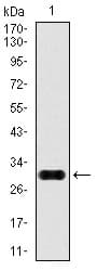 Monoclonal Mouse anti-Human GPC3 / Glypican 3 Antibody (clone 9C2, aa55-200, IHC, IF, WB)
