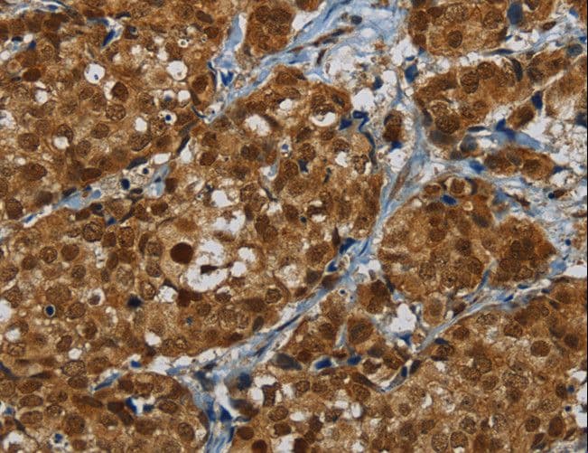MRE11A / MRE11 Antibody