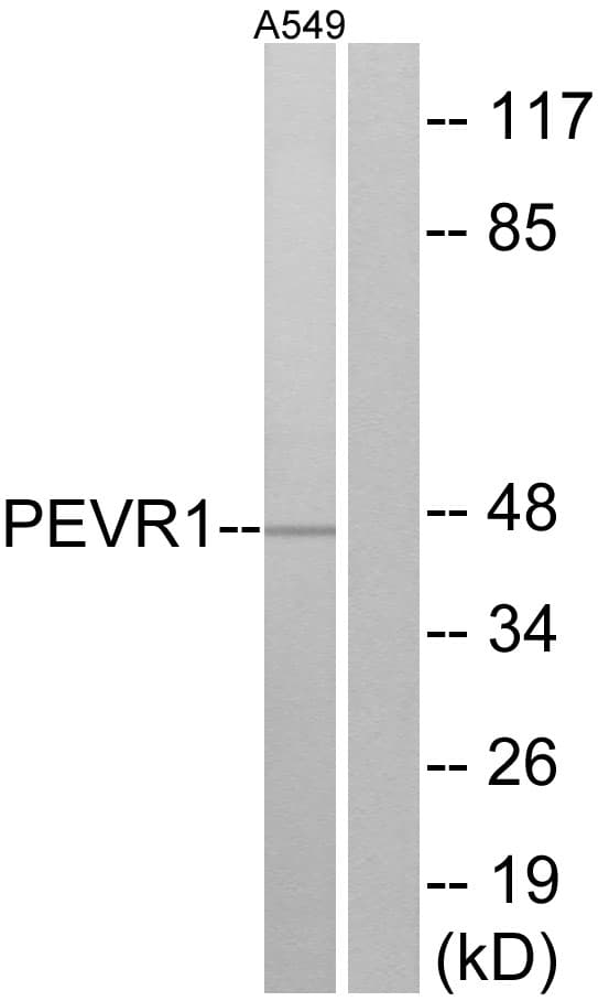 Polyclonal Rabbit anti-Human SLC52A2 / GPR172A / PAR1 Antibody (aa43-92, IF, WB)