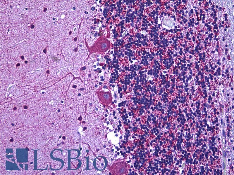 IHC-plus™ GAD / Glutamate Decarboxylase Antibody (aa545-594)