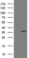 RFC2 / RFC40 Antibody (clone OTI4C5)