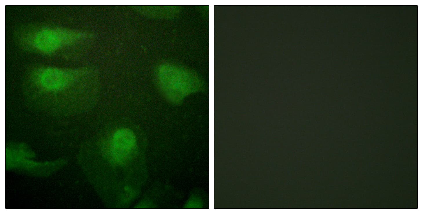 CAMK1 / CAMKI Antibody (phospho-Thr177)