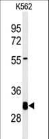 Polyclonal Rabbit anti-Human KCTD7 Antibody (aa95-123, WB)