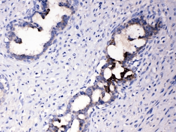 ATF6 Antibody