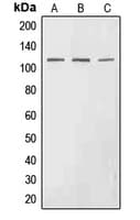 EPHA3 / EPH Receptor A3 Antibody (phospho-Tyr602)