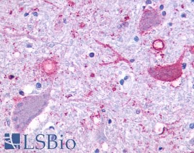 PathPlus™ Polyclonal Rabbit anti-Human ADGRF1 / GPR110 Antibody (N-Terminus, IHC)