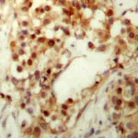 TP53 / p53 Antibody (N-Terminus)