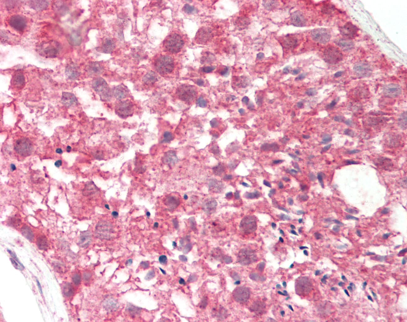 IHC-plus™ OASL Antibody