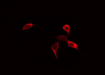 Polyclonal Rabbit anti-Human EIF4B Antibody (phospho-Ser422, IHC, IF, WB)