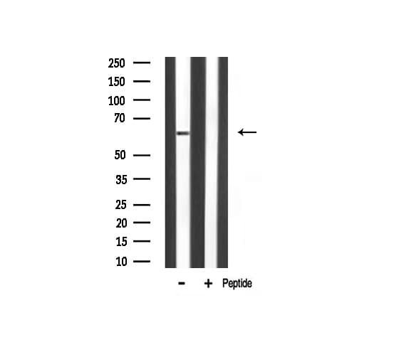 RELA / NFKB p65 Antibody