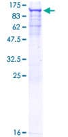 Human SNRK Protein (Recombinant GST)