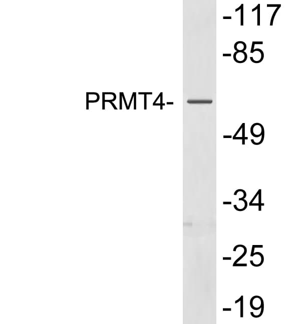 Polyclonal Rabbit anti-Human PRMT4 / CARM1 Antibody (aa322-371, WB)