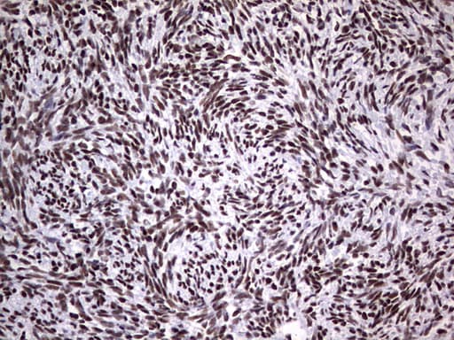 Monoclonal Mouse anti-Human PPP1R8 / Rnase E Antibody (clone OTI4E5, aa1-225, IHC, WB)