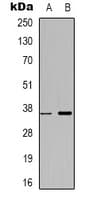 Polyclonal Rabbit anti-Human ZRANB2 / ZNF265 Antibody (Internal, IHC, IF, WB)