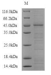 Human BTC / Betacellulin Protein (Recombinant GST, N-terminus)