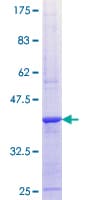 Human ALPK1 Protein (Recombinant GST, N-terminus)