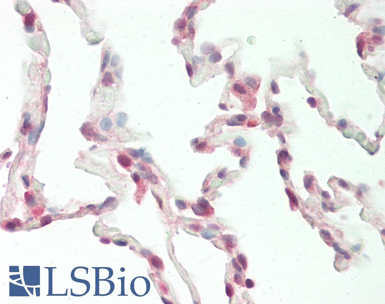 PREP / Prolyl Endopeptidase Antibody (C-Terminus, FITC)