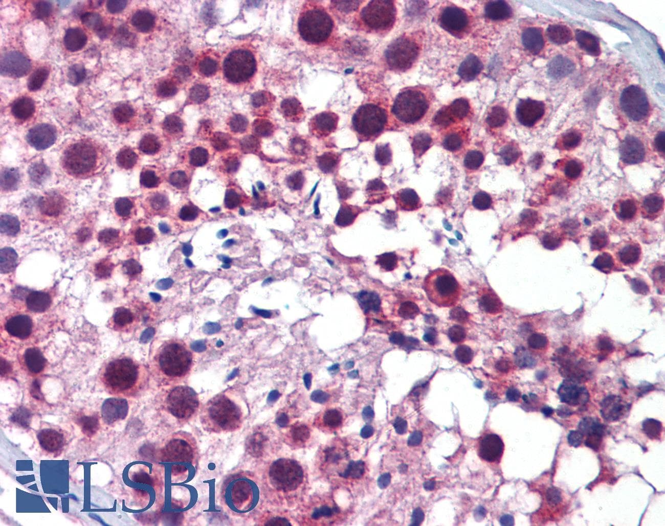 PLK1 / PLK-1 Antibody (C-Terminus)