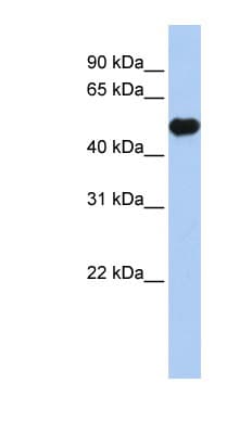 KCNJ12 / Kir2.2 Antibody (aa360-409)