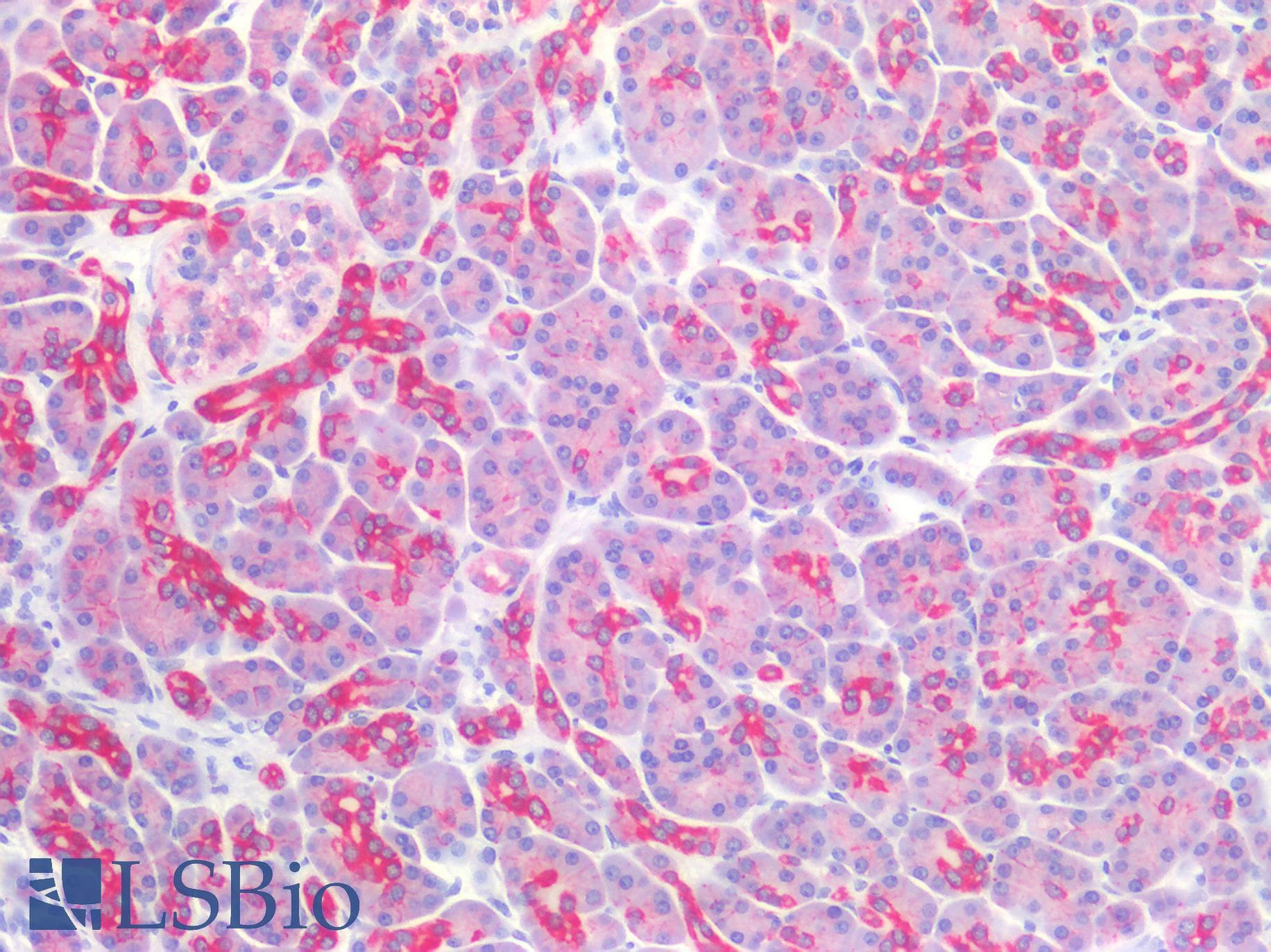PathPlus™ CLDN4 / Claudin 4 Antibody (C-Terminus)