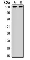 Polyclonal Rabbit anti-Human CACNA2D2 Antibody (WB)
