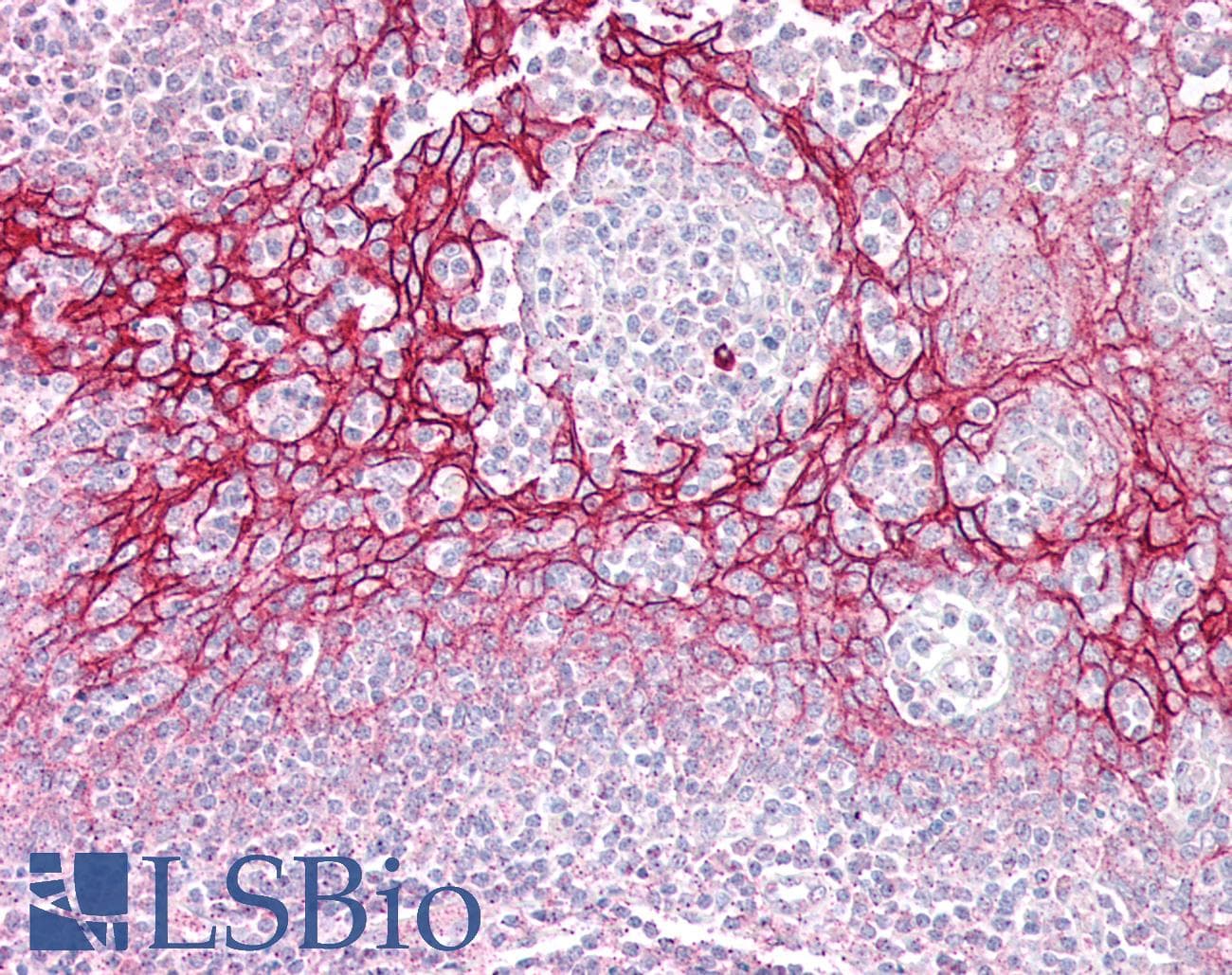 IHC-plus™ Polyclonal Rabbit anti-Human DSC2 / Desmocollin 2 Antibody (IHC, WB)