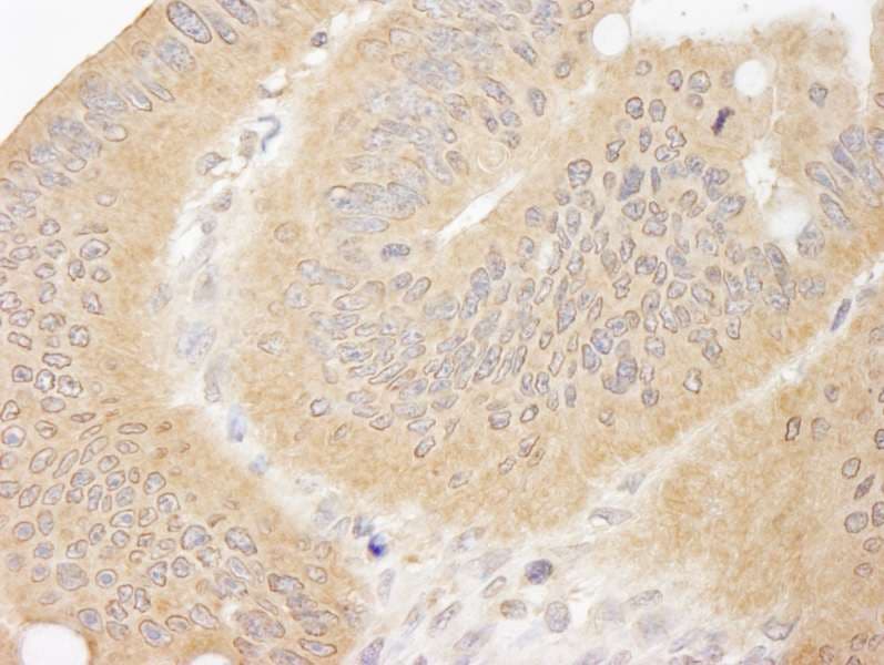 CC2D1A Antibody (aa1-50)