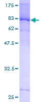 Human MEF2D Protein (Recombinant GST)