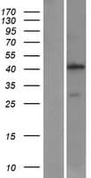 AMT Protein (Over-Expression Lysate Myc-DDK (Flag))