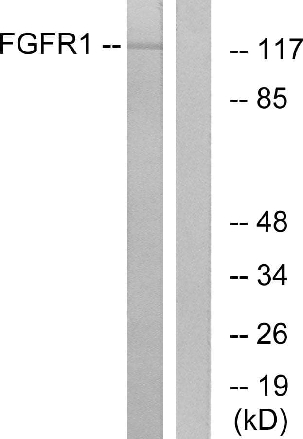 FGFR1 / FGF Receptor 1 Antibody (p766)