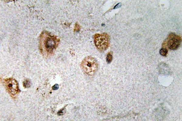 NCOA3 / SRC-3 / AIB1 Antibody (Ser587)