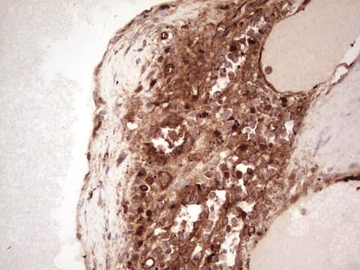 LGALS9 / Galectin 9 Antibody (clone OTI1D12)