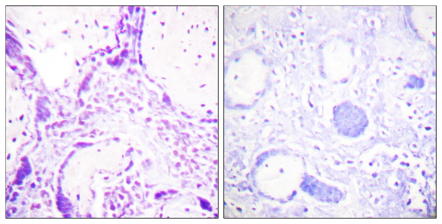 PPARG / PPAR Gamma Antibody (p112)