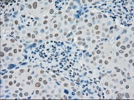 Monoclonal Mouse anti-Human PMEL / SILV / gp100 Antibody (clone OTI10E5, IHC, IF, WB)