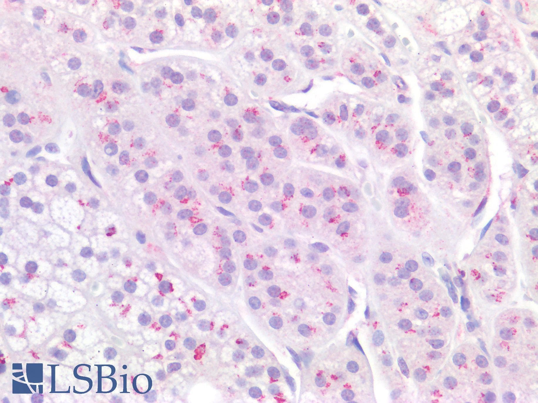 IHC-plus™ Polyclonal Rabbit anti-Human SIAH2 Antibody (IHC)