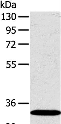 SULT2A1 / Sulfotransferase 2A1 Antibody