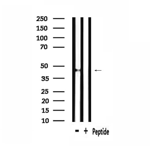 GnRH-II-R / GNRHR2 Antibody