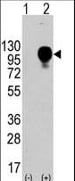 Polyclonal Rabbit anti-Human LAMP2 / CD107b Antibody (aa196-225, WB)