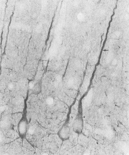 DLG4 / PSD95 Antibody (clone 7E3)