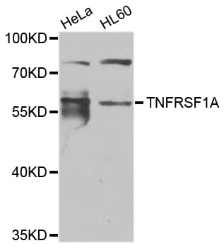 Polyclonal Rabbit anti-Human TNFRSF1A / TNFR1 Antibody (IHC, IF, WB)
